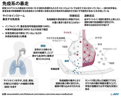 新型コロナ、ウイルス感染で免疫系が過剰反応 命の危険も