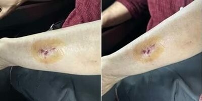 韓国・バスで幼児・その義母に無差別暴行…加害女性が口にした「ある障害」とは