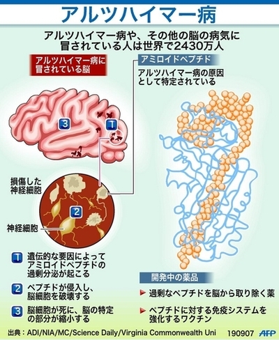アルツハイマー病のメカニズム