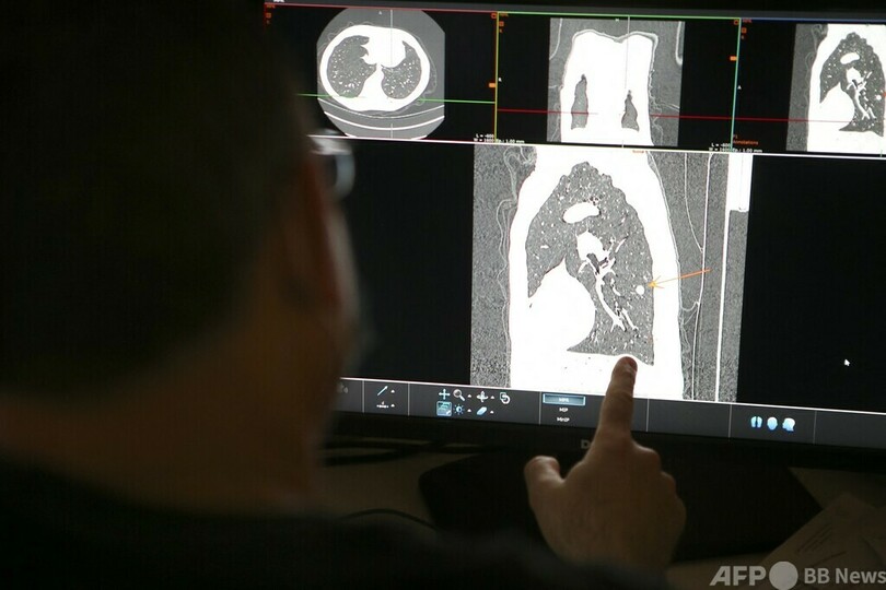 Xマス祝賀の代わりにがん宣告 英診療所、患者に誤送信
