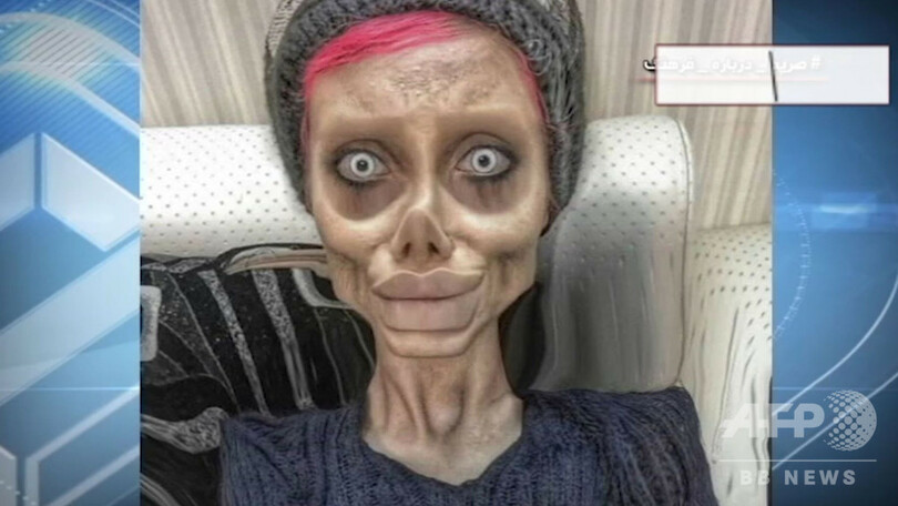 美容整形で「ゾンビ」顔に…有名インスタグラマーが後悔語る イラン