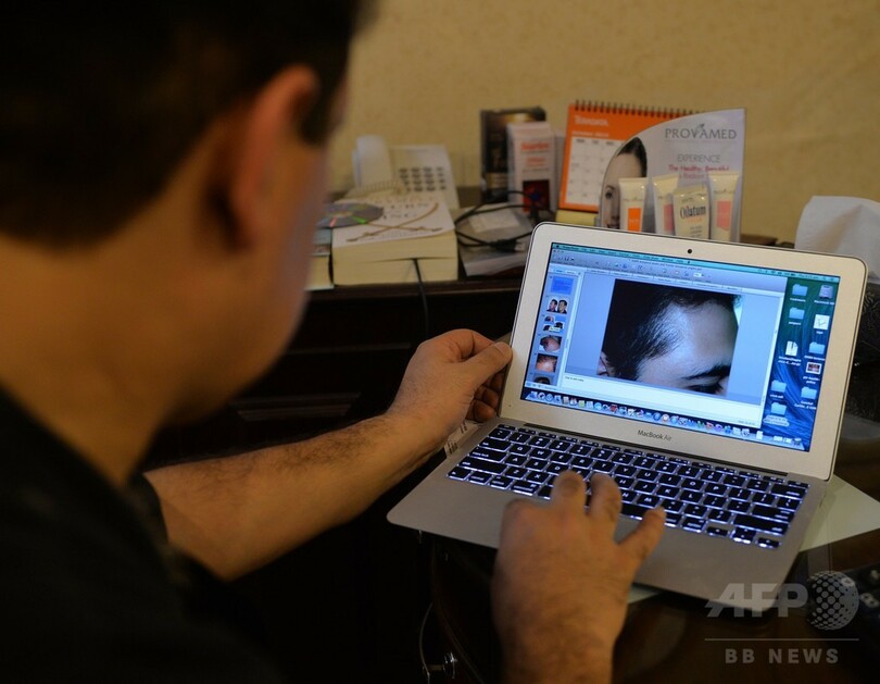 「髪は男の武器」、パキスタンで植毛手術が大人気