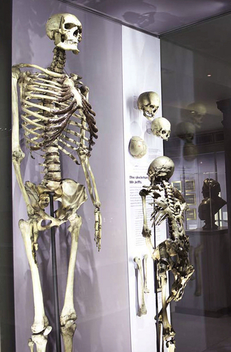 「アイルランドの巨人」に安らかな眠りを、英医学者が主張