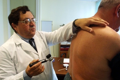 黒色腫患者のリンパ節切除、延命につながらず 研究