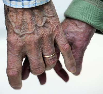 バイリンガルはアルツハイマー病の発症が5年遅い、カナダ研究