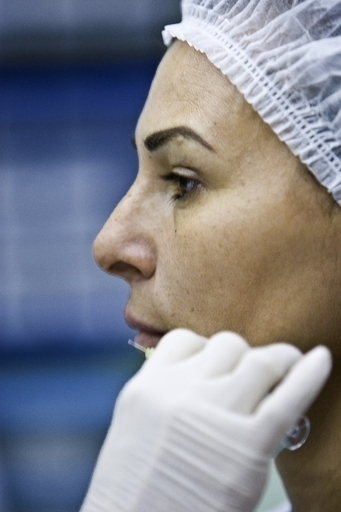 貧困層を対象に無料美容治療、ブラジル