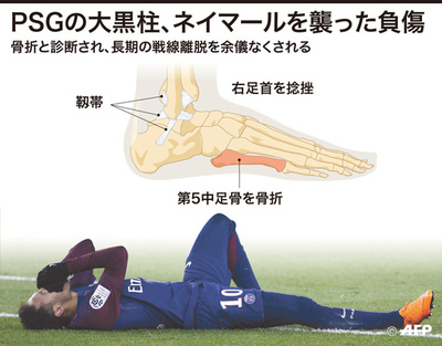 ネイマールの手術が成功、復帰はW杯直前の可能性も