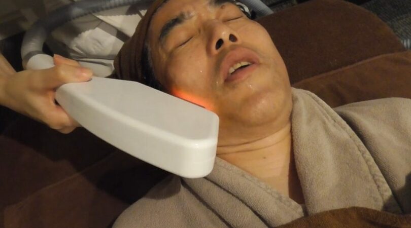 CUBE DUOによる脱毛の様子(c)KOREA WAVE