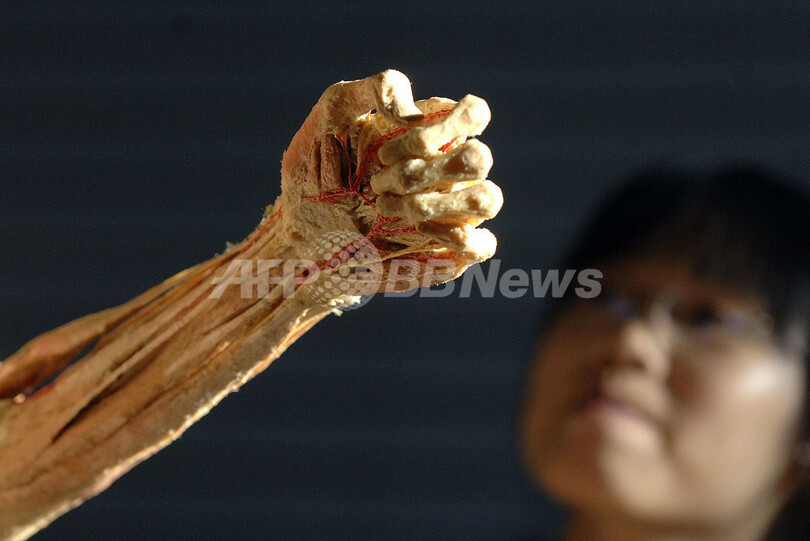 中国で実物の皮膚や臓器を使用した人体展覧会 写真12枚 国際ニュース Afpbb News