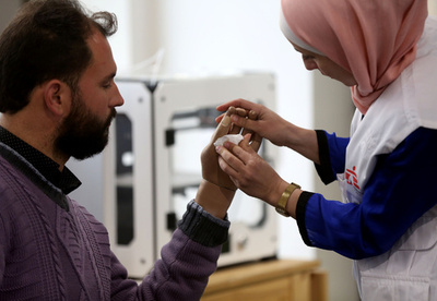 3D印刷の義肢、負傷兵や障害児の希望に ヨルダン