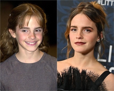 【特集】写真で振り返る海外セレブのビフォーアフター