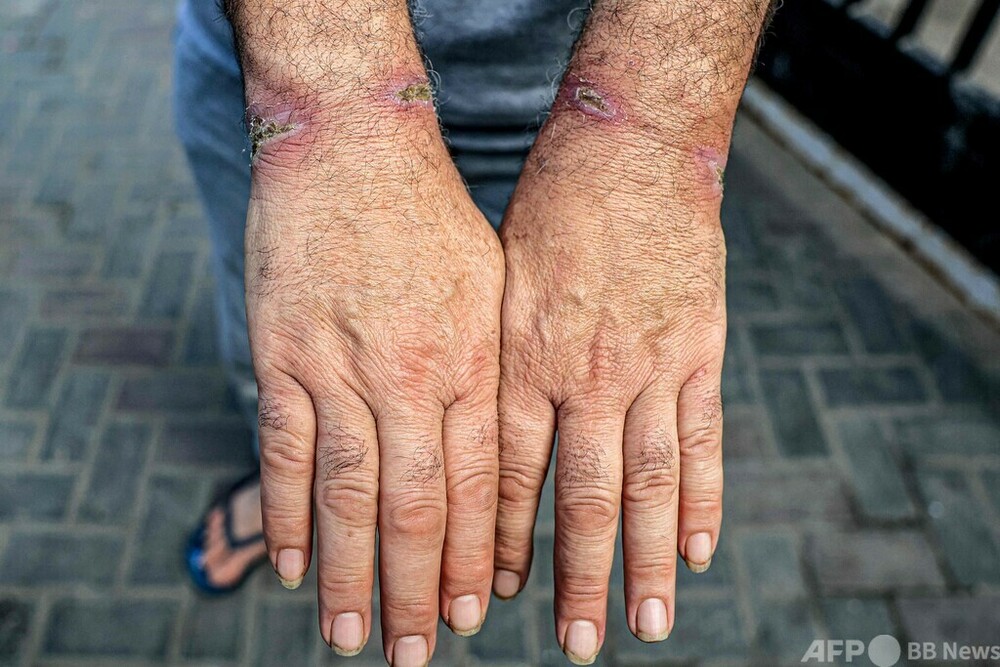 イスラエル軍拘束下で「拷問」 解放のパレスチナ男性ら主張 写真10枚 国際ニュース:AFPBB News