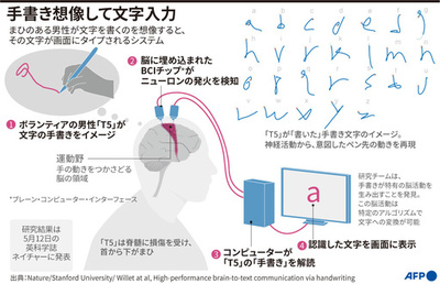 手書き想像して文字入力 まひの患者助ける脳インプラント技術