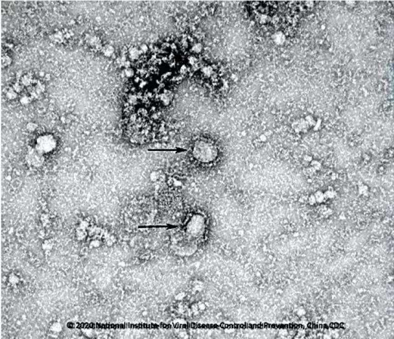 中国で初めて新型コロナウイルスの分離に成功、疾病予防控制センターが電子顕微鏡写真を公開 写真2枚 国際ニュース:AFPBB News