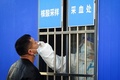 中国・宜昌の鉄道駅外で新型コロナウイルスの検査を受ける男性（2021年1月28日撮影）。(c)STR / AFP