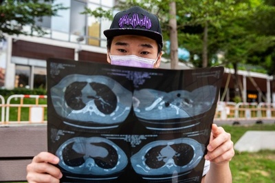 香港デモで警察の銃撃受けた元高校生、出廷せず 亡命か