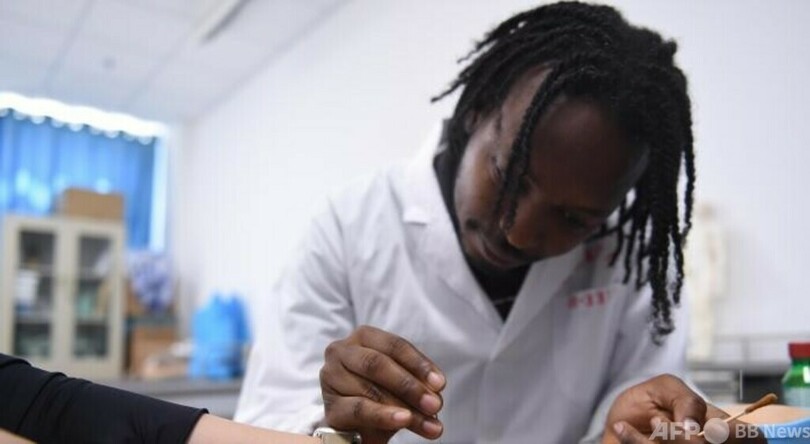 1本の針で苦しむ人を救う 病院も薬もないアフリカで貢献する中国医学