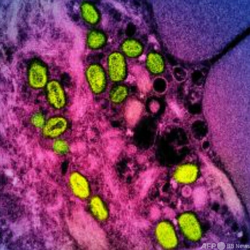 サル痘を「エム痘」に WHO、名称変更へ