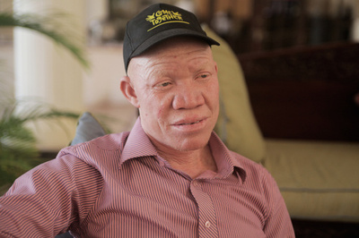 選挙と呪術、タンザニアでおびえ暮らすアルビノの人々