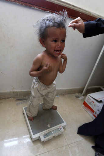 サウジ、イエメン救済へ2200億円の送金発表