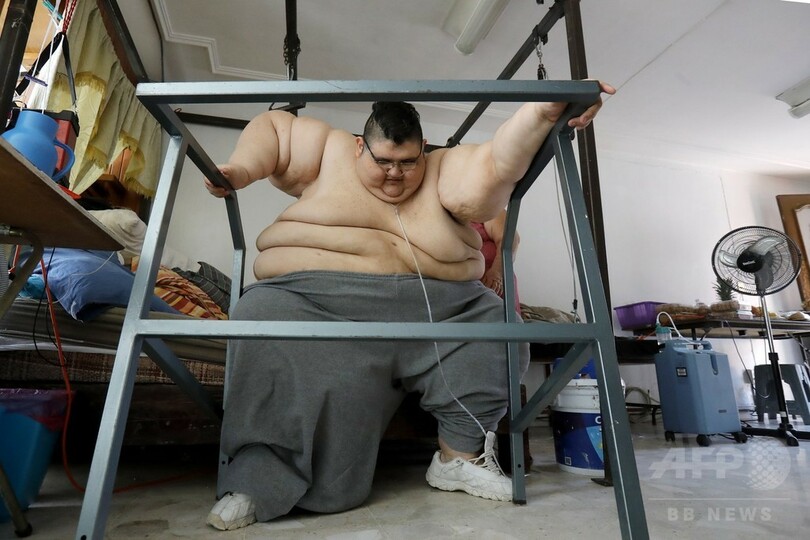 世界で最も重かった男性、250キロ減量 再び歩けることを夢見て
