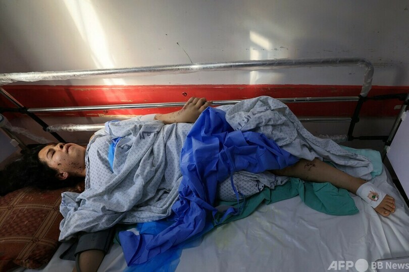 「自分・家族のため強くなりたい」 ガザ空爆で脚を切断された子どもたち