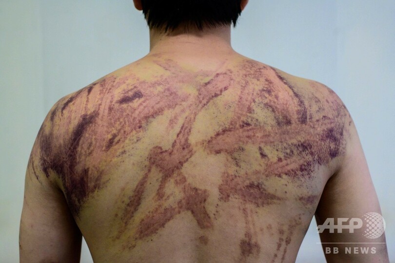 白服集団による香港デモ隊襲撃、巻き込まれた男性が恐怖語る