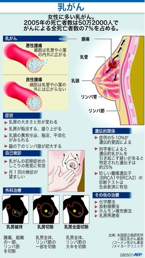 がんによる全死亡者数の7％を占める乳がん、その症状と治療法は？