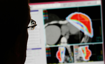 腫瘍と正常組織を瞬時に見分けるメス「アイナイフ」