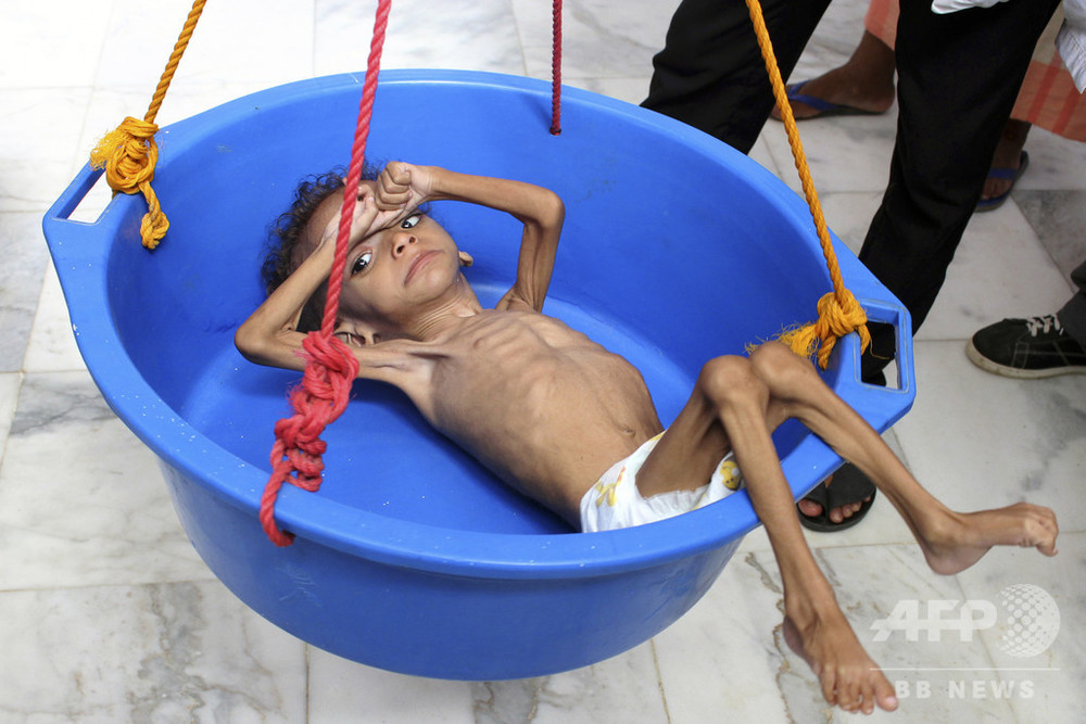 近東と北アフリカで飢餓拡大 50万人以上が栄養不足 Fao 写真3枚 国際ニュース Afpbb News