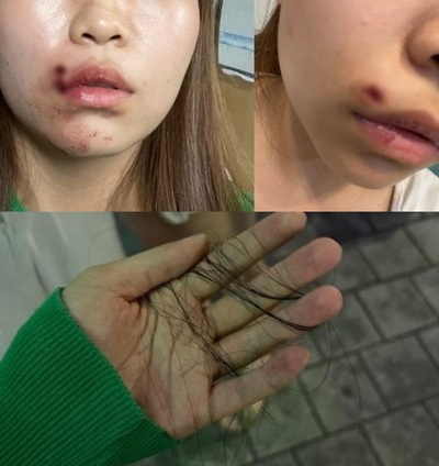 「釜山回し蹴り事件」と同じ…20代女性、コンビニでいきなり殴られ、唇切れ、髪の毛抜けた