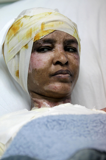 カダフィ大佐の息子妻から虐待、｢熱湯かけられやけど｣乳母が訴え