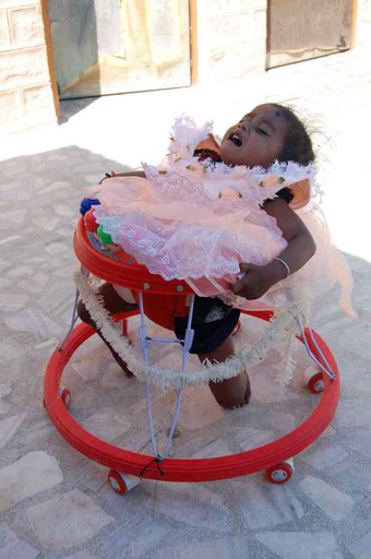 四肢分離手術を受けたラクシュミちゃん、リハビリは順調