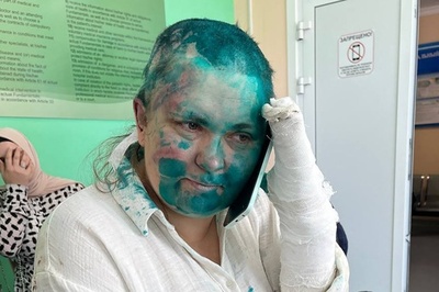 ロシア調査報道記者、暴行受け入院