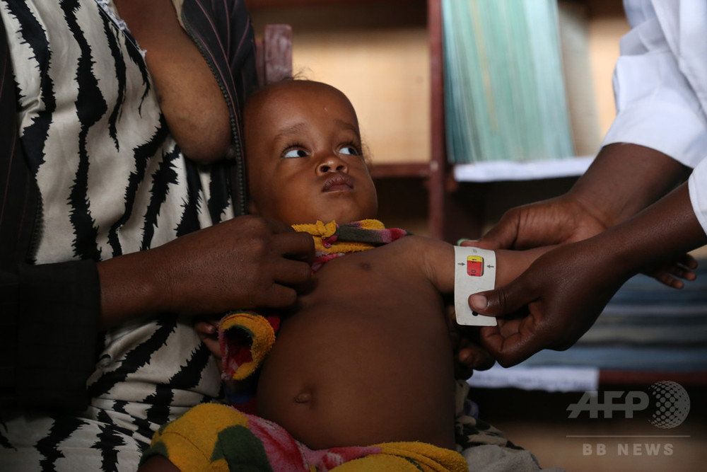 アフリカ 重度栄養失調の子ども100万人 ユニセフ 写真1枚 国際ニュース Afpbb News