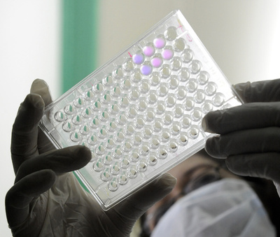 若者のHIV感染者数、10年で約3割増 WHO