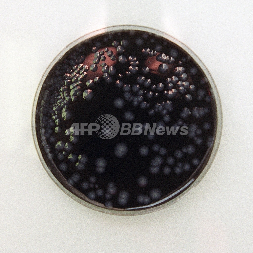 英エディンバラのレジオネラ菌感染、死者2人に 英エディンバラのレジオネラ菌感染、死者2人に