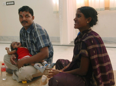 分離手術を受けたラクシュミちゃん、元気に退院