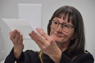 顔面欠損の患者、安価な「新たな顔」を3Dプリンターで手に ブラジル