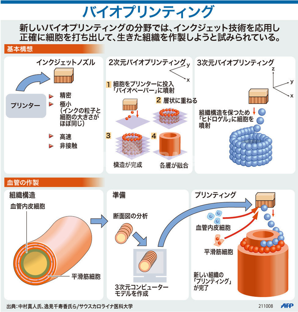 【図解】再生医療で注目される「バイオプリンティング」 写真1枚 国際ニュース:AFPBB News 【図解】再生医療で注目される「バイオプリンティング」 写真1枚 国際ニュース:AFPBB News
