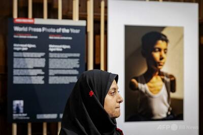 両腕失ったパレスチナ少年の肖像、世界報道写真大賞を受賞