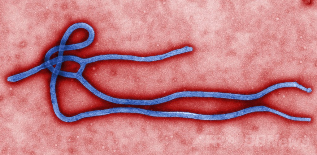 西アフリカからの帰国者、エボラ出血熱を発症か カナダ 西アフリカからの帰国者、エボラ出血熱を発症か カナダ