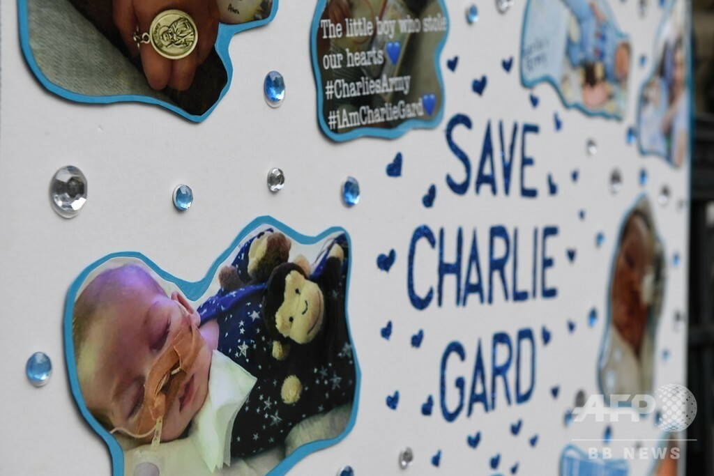 【写真特集】世界各地で報告されている「難病・奇病」