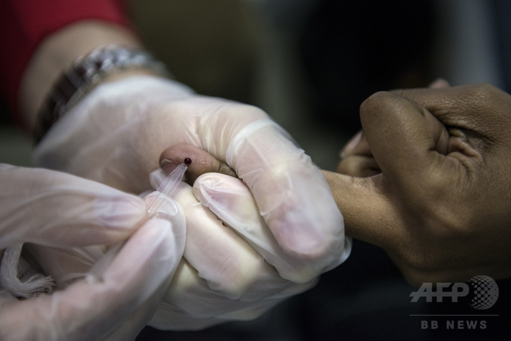 スマートフォンでHIVと梅毒を検査、新技術開発 米研究 スマートフォンでHIVと梅毒を検査、新技術開発 米研究