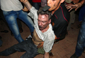 襲撃されたリビア・ベンガジ（Benghazi）の米領事館で救出された意識不明の男性。後にJ・クリストファー・スティーブンス（J. Christopher Stevens）駐リビア米国大使と確認された（2012年9月11日撮影）。(c)AFP