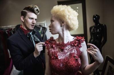 アルビノへの偏見乗り越えモデルに、南アのタンド・ホパさん