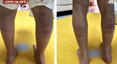 体罰で子どもにムチ打ち、写真をSNS投稿…韓国・母親の虐待行為に非難殺到