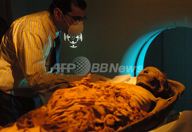 古代エジプト女王のミイラを特定　歯が決め手に