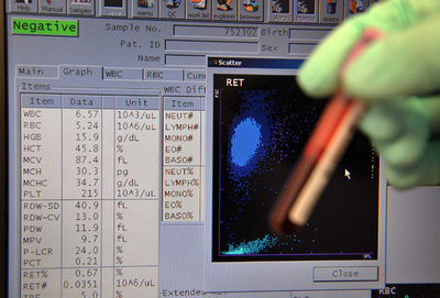 WADA会長、いたちごっこ終わらせるため「賢い検査」を