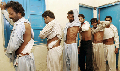 貧困層を狙う違法臓器売買、パキスタン政府が外国人への販売を禁止